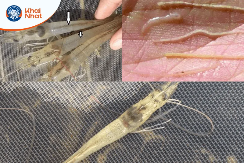 Xuất hiện phân trắng hoac hoa vàng nâu nổi