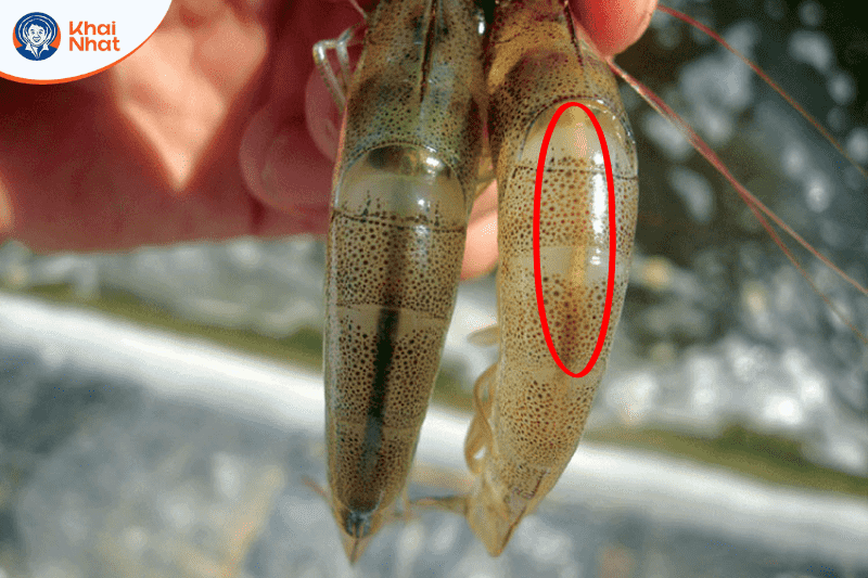 vi-khuan-gram-am (4)