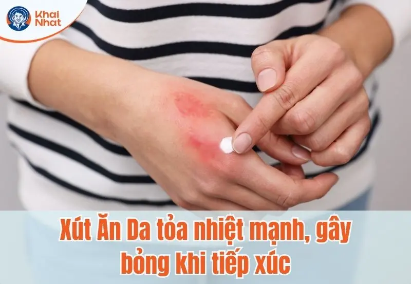 Tỏa nhiệt mạnh, gây bỏng khi tiếp xúc với xút ăn da