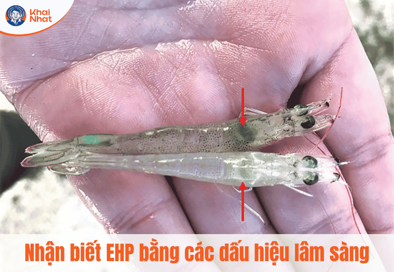 dau-hieu-nhan-biet-tom-bi-nhiem-ehp