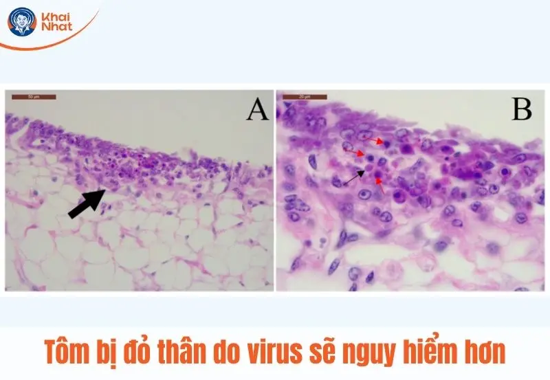 tôm bị đỏ thân nguy hiểm hay không